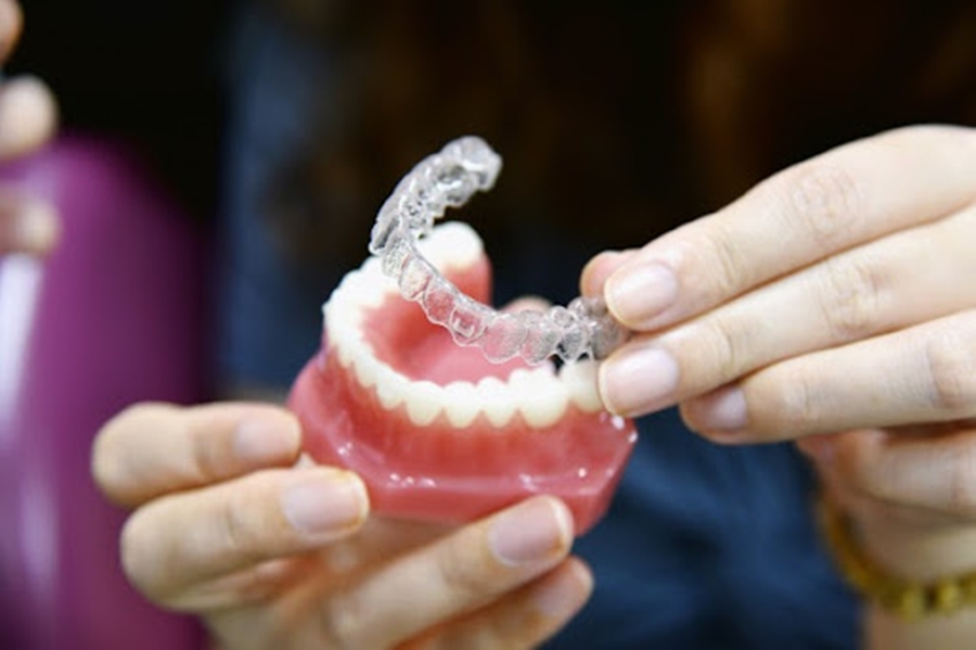 This Is How Clear Braces Work.