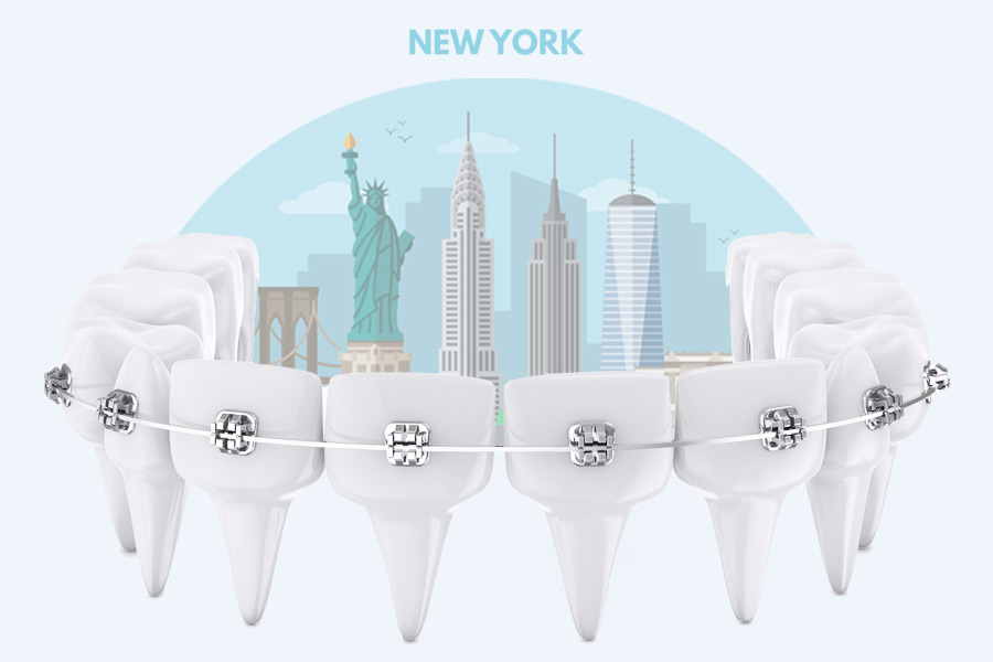 Cost Of Braces In New York