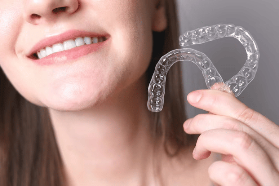 Invisalign Cost in Virginia