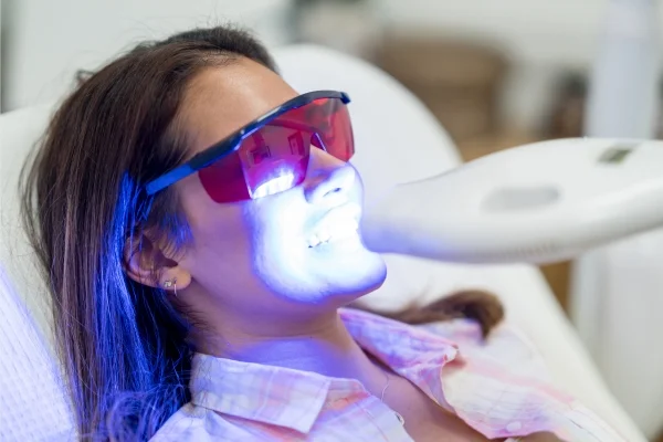 Lasers for teeth whitening