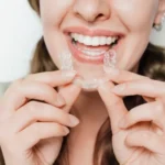 Discover the Magic of Multifunctional Invisible Braces: A Complete Guide