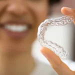 Smilepath vs Invisalign: Which One Should You Choose?