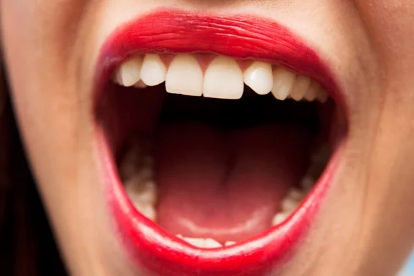 A close-up image of a woman with uneven teeth